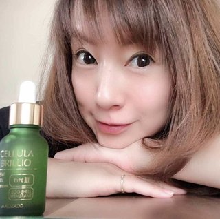 鈴木亜美って整形してるの？