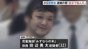 小５男子頭骨折、逮捕の男「自分で転んだ」と説明