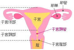 子宮けいがんの再検査