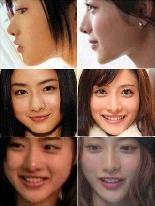石原さとみってやはり整形だよね？
