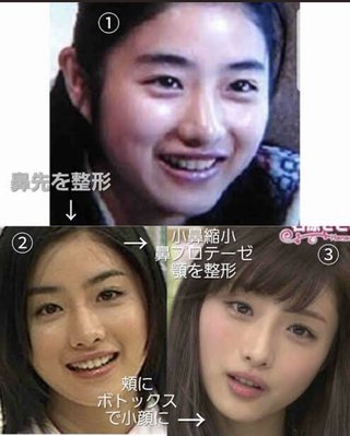 石原さとみって絶対整形してないよね？