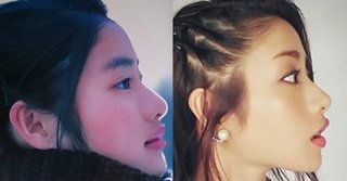 石原さとみって絶対整形してないよね？