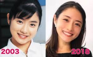 石原さとみって絶対整形してないよね？