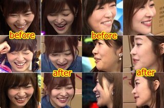 【画像】指原莉乃さんの涙袋が限界突破 	 