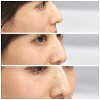 田中みな実、柏木由紀、内村光良。この３人に似てると言われたら、どれを信じる？