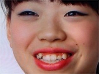 フィギュアスケート【総合】