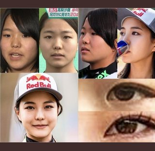 高梨沙羅ちゃんの整形を批判する人いるけどさ