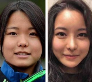 高梨沙羅ちゃんの整形を批判する人いるけどさ