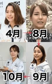 高梨沙羅ちゃんの整形を批判する人いるけどさ