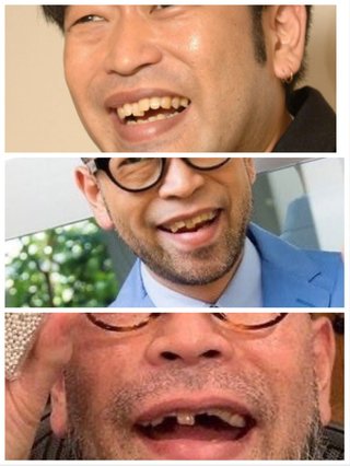 槇原敬之歯の歴史