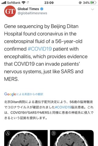 イルミナティこわいね