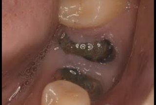 歯医者について、お話聞いてもらえませんか？