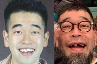 槇原被告「ボロボロ歯」の謎を追跡　あごヒゲ、荒れた肌に前歯１本