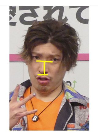 EXITのりんたろー。整形を告白も「誰にも気づかれず…」歯も矯正