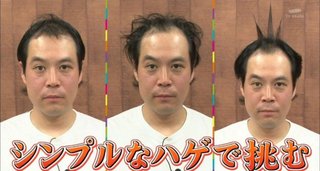「タカトシ」タカ“髪ングアウト”前髪禿げ