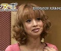 35歳辺りから老けこむ人とそうでない人って何が違う？