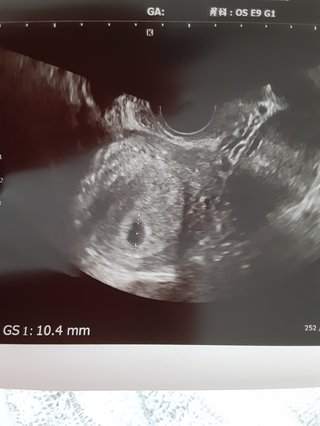 5w5dのエコーで聞きたいです。