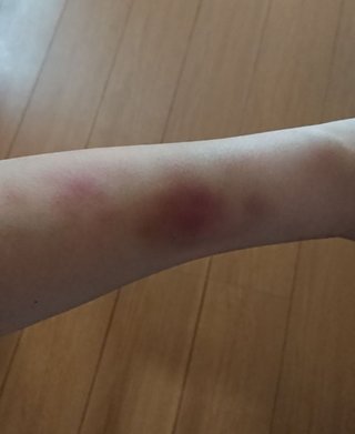 【総合】うつ病【ｳﾂ、ﾊﾟﾆ他、心療内科系】