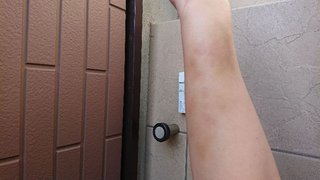 【総合】うつ病【ｳﾂ、ﾊﾟﾆ他、心療内科系】