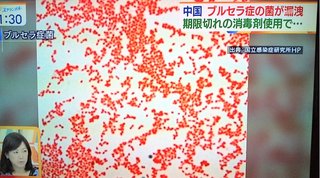 【中国】ワクチンずさんな管理でブルセラ菌が漏洩､3000人感染 ※かつて生物兵器として研究･培養