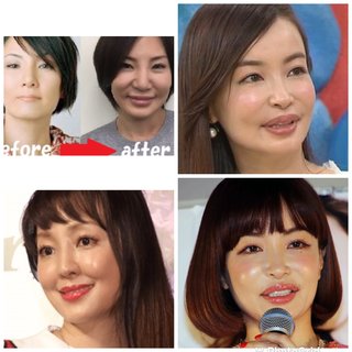 整形すると芸能人ってアンパンマンにならない？