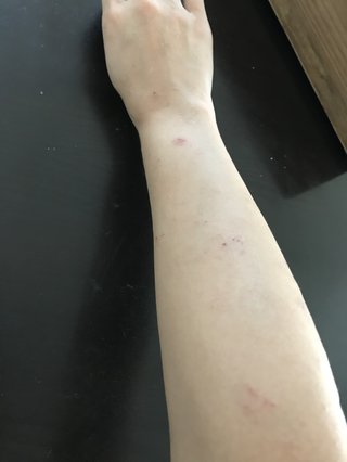 皮膚がやばい
