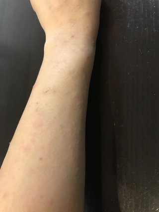 頭皮が痒い！！