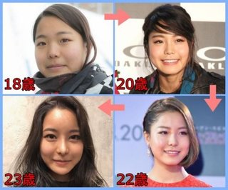 高梨沙羅ちゃん 美人に