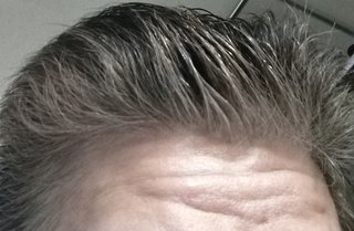 【白髪】レストリアディスクリートについて