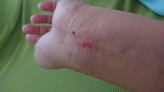 【総合】うつ病【ｳﾂ、ﾊﾟﾆ他、心療内科系】