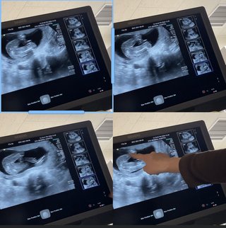 性別はどちらだと思われますか？