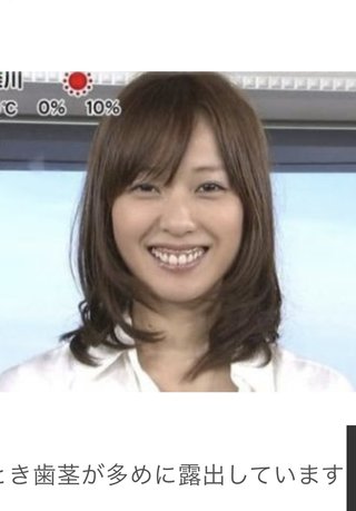 戸田恵梨香って出っ歯じゃん