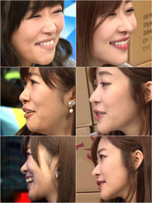 昔の指原莉乃みたいに黄色っぽい肌なんですが