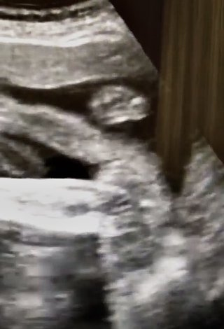 性別はどちらだと思われますか？