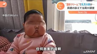 中国の抗菌クリームで乳児の顔が肥大  批判殺到