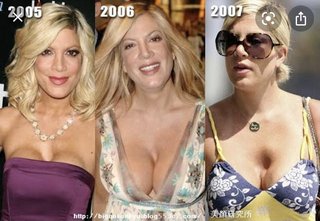 田中みな実の胸って豊胸とかじゃなくて元から？