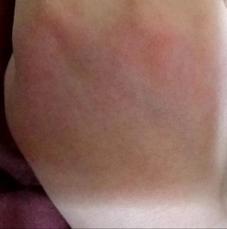 『病気糧』ちら裏