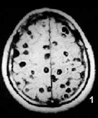 「色が変」…男性が裸で漬けている「中国産キムチ」＝韓国報道