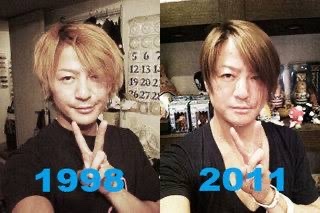 GLAYのTERUどうしちゃったの？