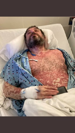 コロナワクチン接種について