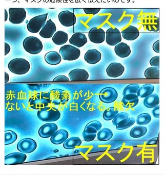 マスクの長時間着用で脳や肺に深刻なダメージ