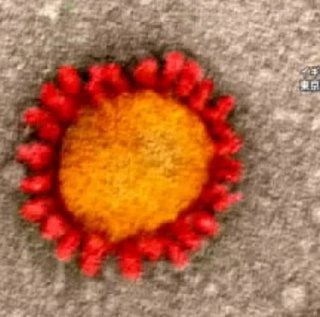 北海道 "過去最多" 324人感染 (札幌244、旭川19、函館10、小樽4、石狩地方31など)