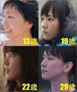 ガッキーって整形なのに美人扱いされてムカつく