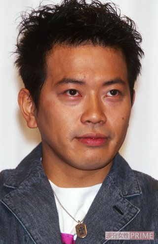 宮迫博之「整形手術」を告白！