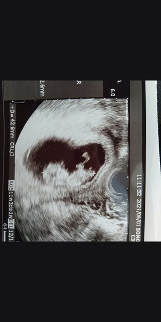 ベビーナブについて