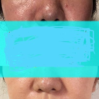 超敏感肌の人でも使えるスキンケア商品を教えてください