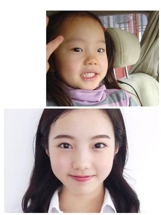 本田真凜って目が離れ気味で、本人も気にしてる感じだったのに