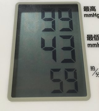 血圧が177の109