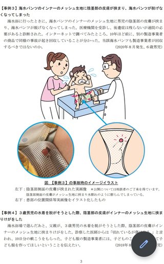 男児用水着、メッシュの裏地は陰茎の皮膚はさまるおそれ