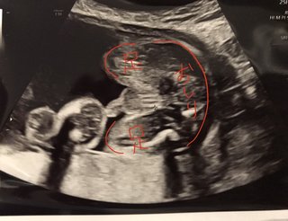 (エコーあり)これは男の子確定ですよね？